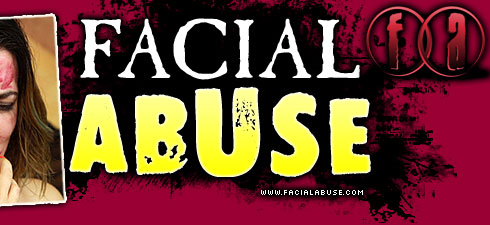 Mariska Benson Degraded on Facial Abuse